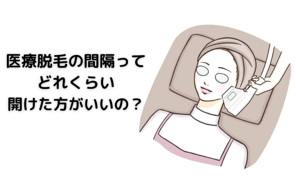 脱毛の間隔ってどれくらい開けた方がいいの？ というテーマの記事です。 適切な脱毛間隔、早すぎる場合、開けすぎた場合のリスクについても解説しました。